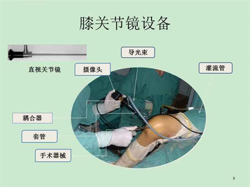 关节镜下无源手术器械产品注册审查指导原则（2021年第102号）(图1)