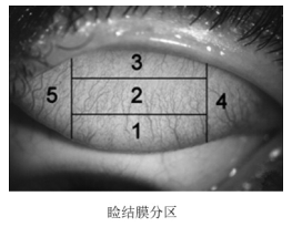 软性接触镜临床评价注册审查指导原则（2023年第33号）(图1)