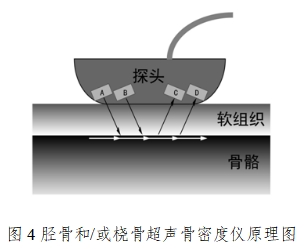 超声骨密度仪注册技术审查指导原则（2017年第180号）(图4)