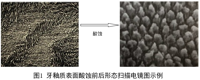 牙科用磷酸酸蚀剂注册审查指导原则（2022年第41号）(图1)