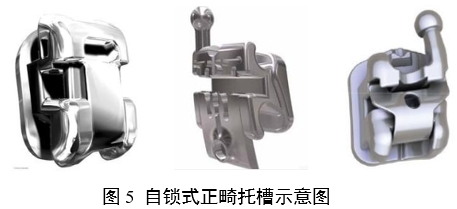 正畸托槽注册审查指导原则（2022年第41号）(图5)
