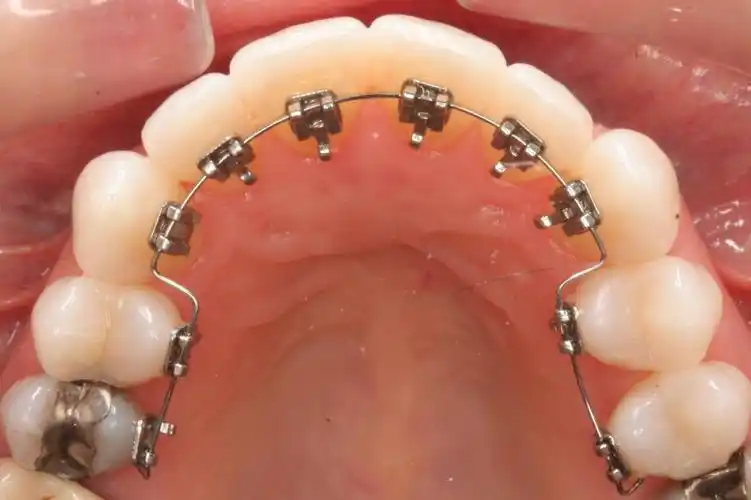 矫治器注册证怎么办理(图2)