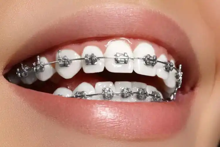 正畸托槽注册证办理流程(图2)