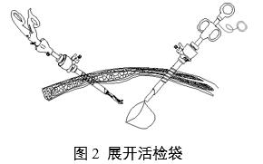 一次性使用内窥镜用活检袋注册审查指导原则(2025年第20号)(图2) 一次性使用内窥镜用活检袋注册审查指导原则(2025年第20号)(图2)