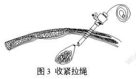 一次性使用内窥镜用活检袋注册审查指导原则(2025年第20号)(图3) 一次性使用内窥镜用活检袋注册审查指导原则(2025年第20号)(图3)