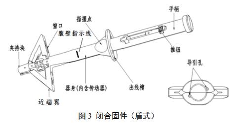 一次性使用微创筋膜闭合器注册审查指导原则（2021年第102号）(图4)